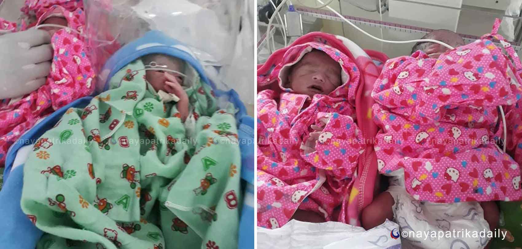 २७ वर्षीया महिलाले जन्माइन् एकै साथ चार शिशु